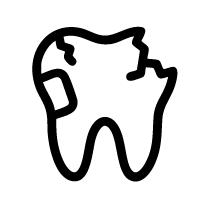 Composite Repair for Broken Corners