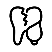 Cracked Tooth Treatment