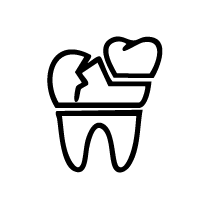 Damaged Tooth Full Coverage Crowns