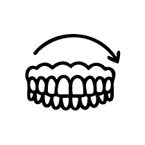 Full Mouth Rehabilitation Crowns