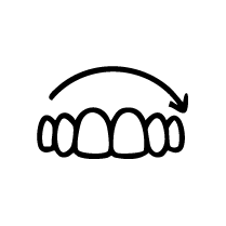 Full Arch Crown Replacement