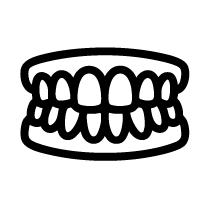 Invisalign for Crossbite