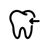 Invisalign for Tooth Movement