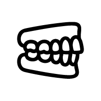 Invisalign for Underbite