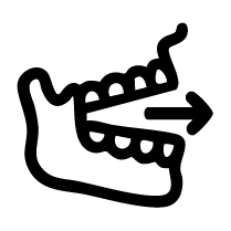 Jaw-Advancing Sleep Devices