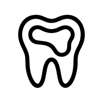 Large Composite Restorations