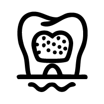 Minimal-Prep Veneers