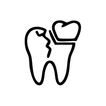 Post-Grinding Full Mouth Restoration