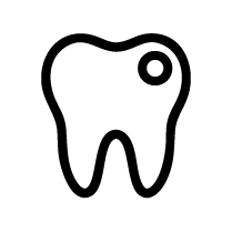 Small Cavity Composite Fillings