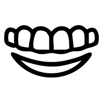 Smile Makeover Veneer Sets